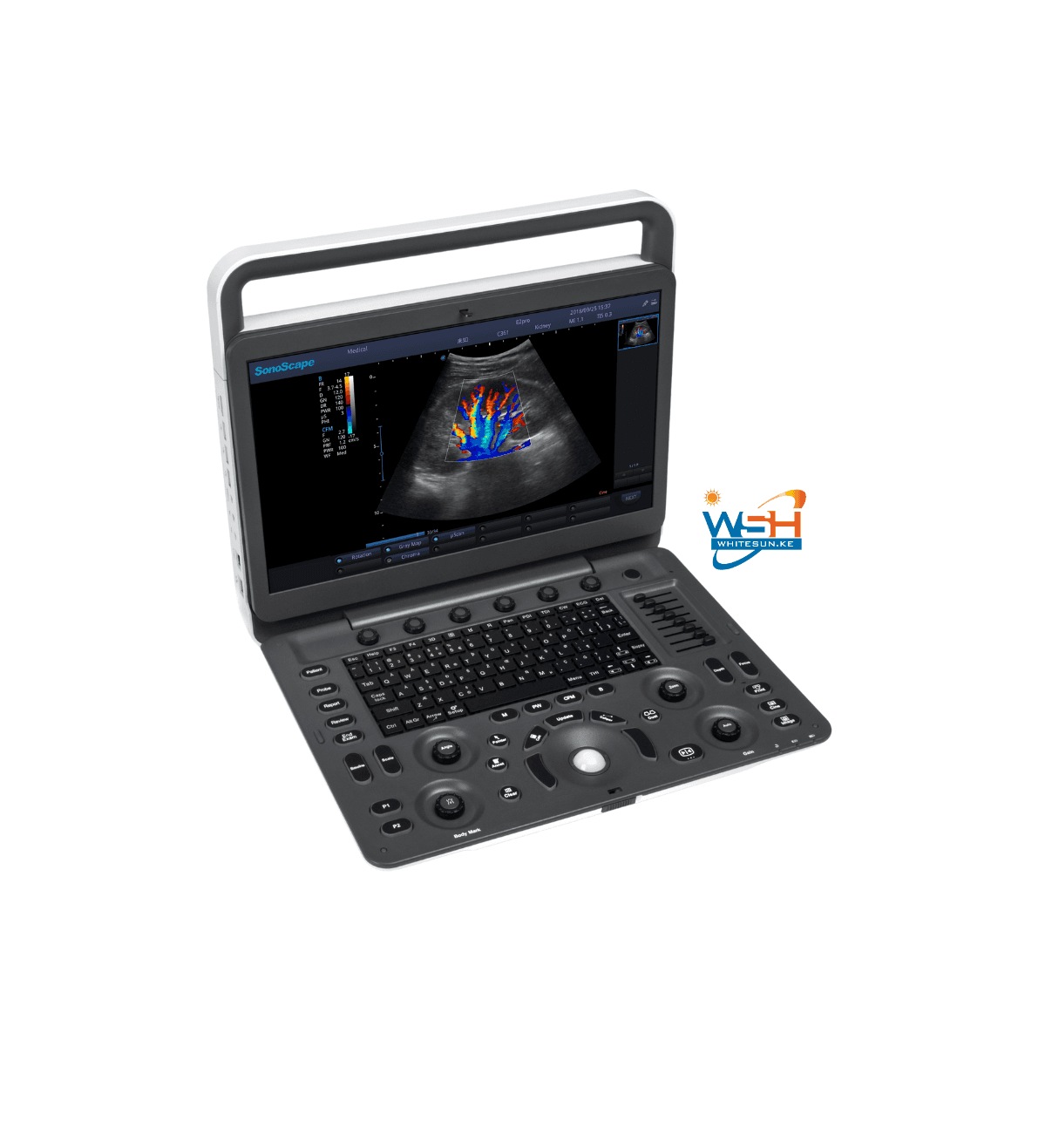 E2 sonoscape Ultrasound scanner